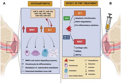 The role of WNT and IL-1 signaling in osteoarthritis: therapeutic implications for platelet-rich plasma therapy
